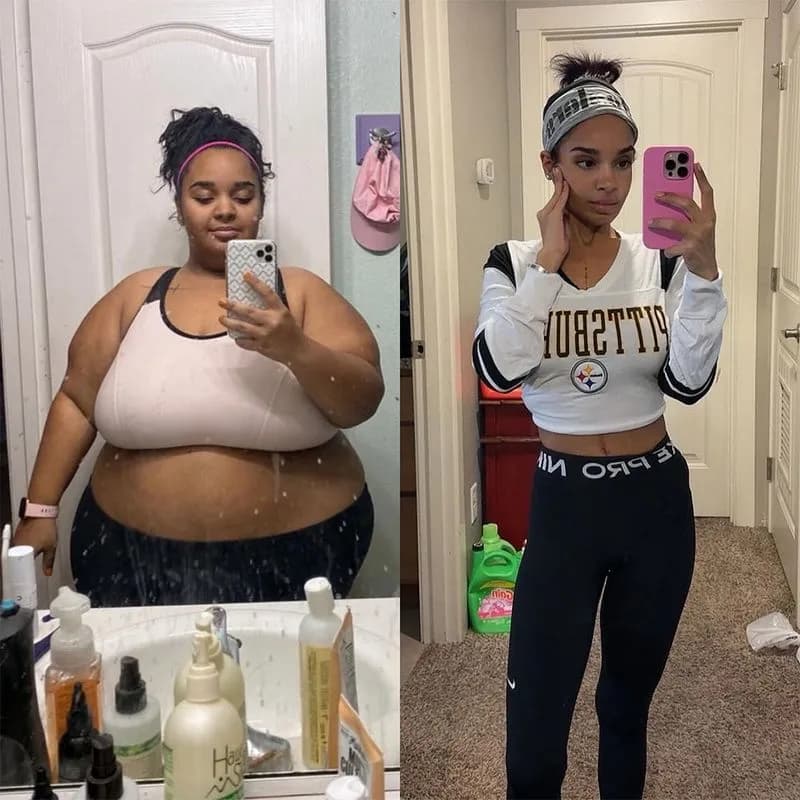 Semaglutide before and after results